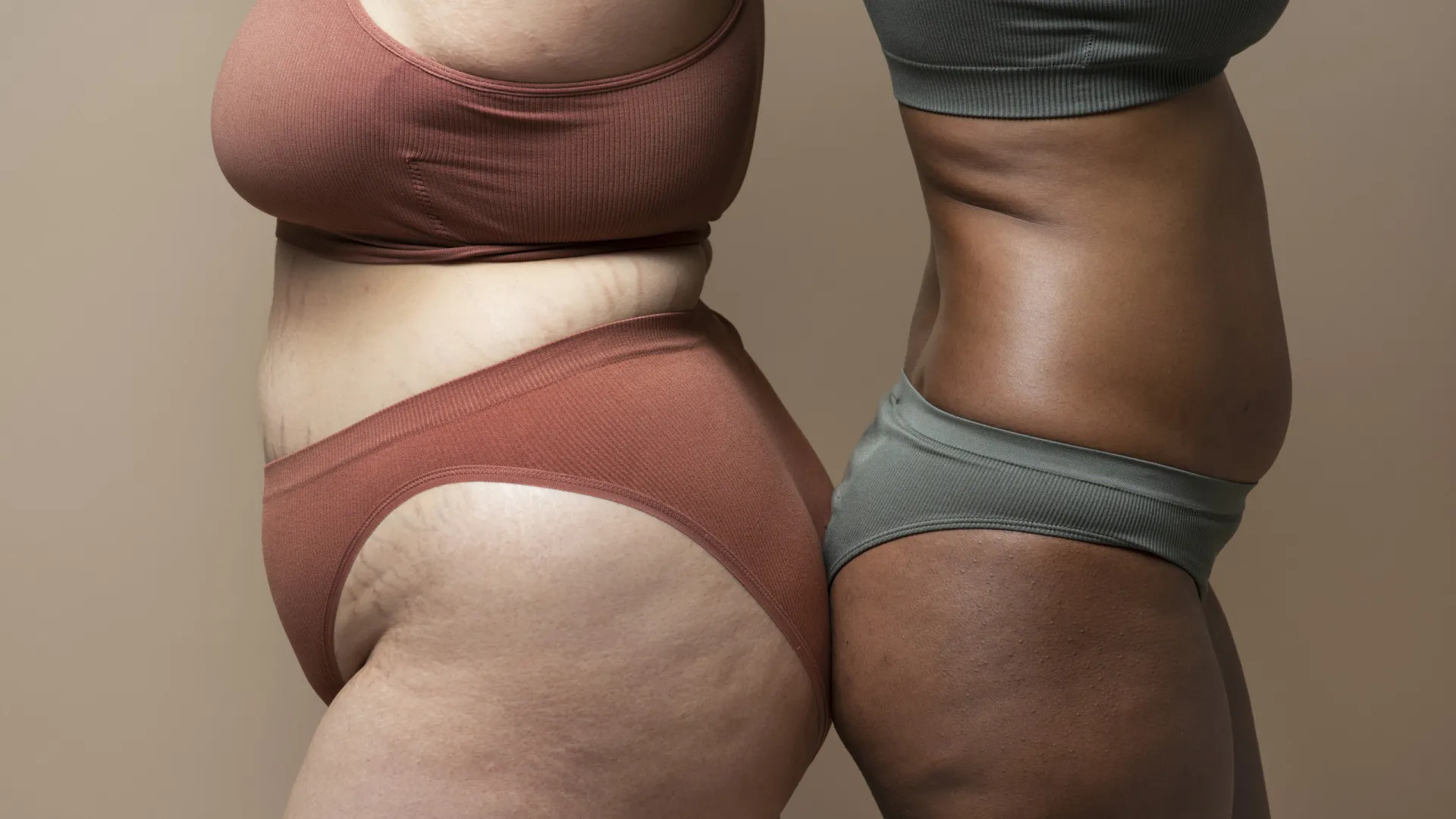 Lipedema: uma doença pouco conhecida e com impacto significativo